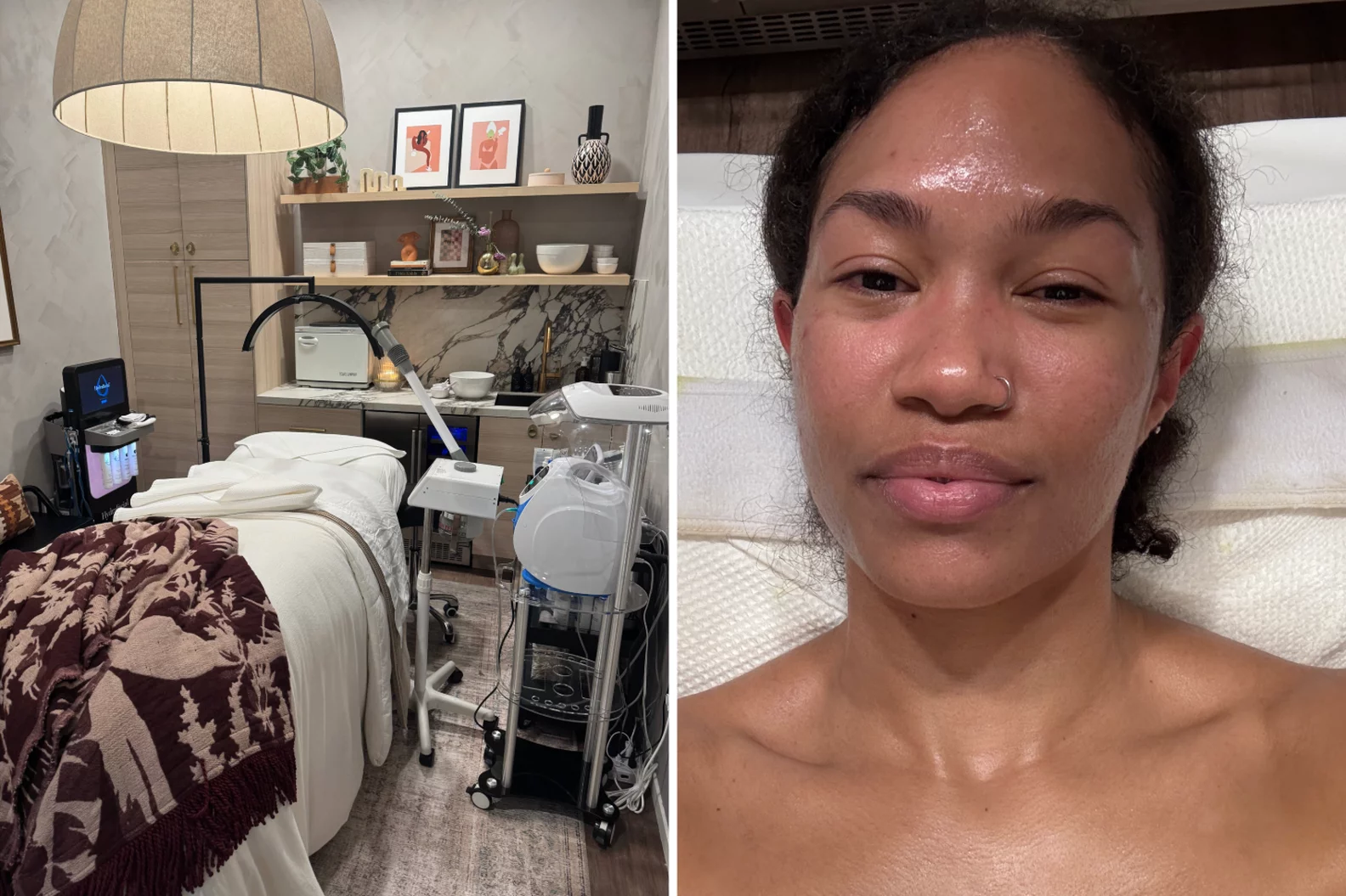 Pop Sugar | I Tried a "Gunk Facial," and It Was So Good For My Acne-Prone Skin